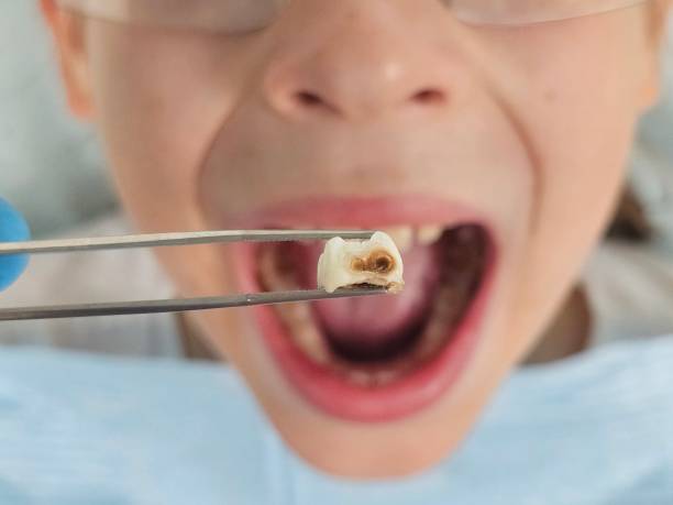 Best Emergency Treatment for Oral Infections in Latta, OK