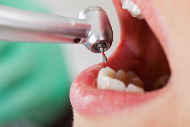 Best Emergency Cosmetic Dentistry (e.g., broken veneers) in Latta, OK
